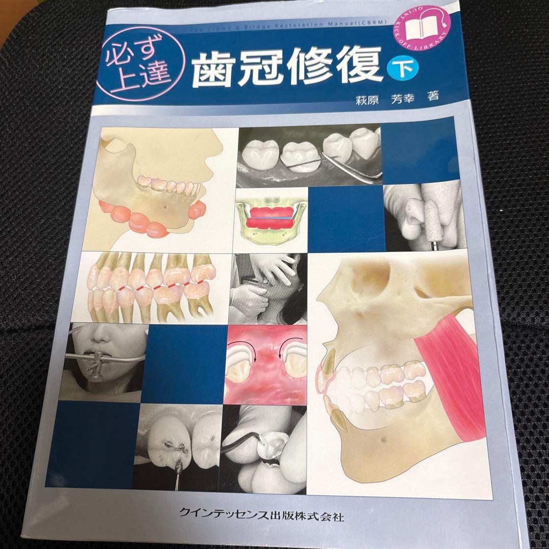 歯冠修復　下　裁断済