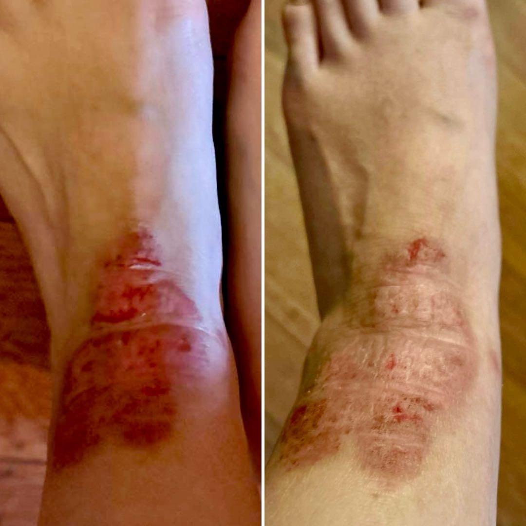 シグナルローション100ml ２本セット