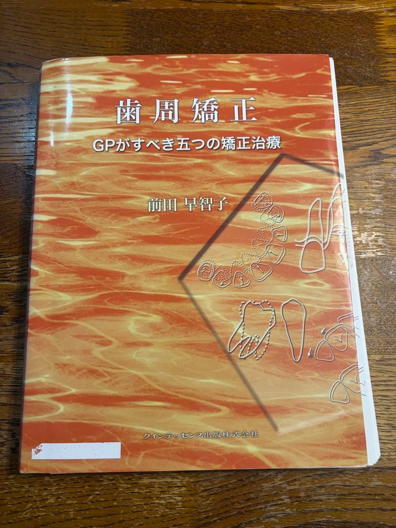 歯周矯正 GPがすべき五つの矯正治療