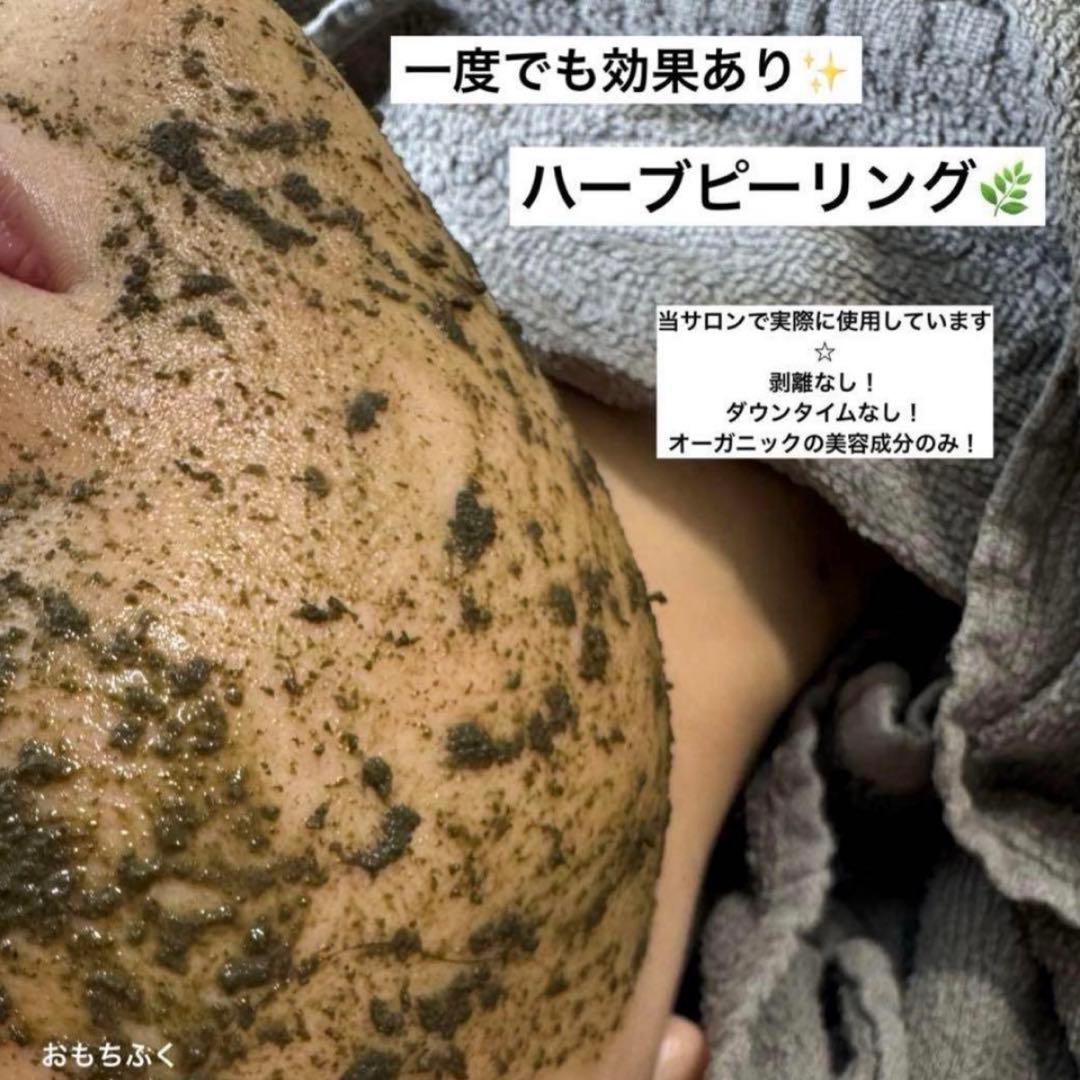 サロン専売品☆ハーブピーリング ダウンタイムなし！剥離なし！肌質改善 小分け販売