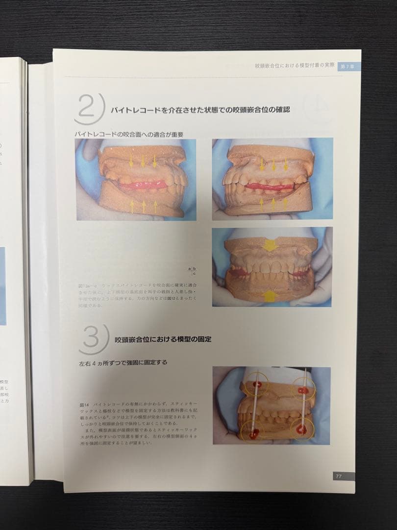 必ず上達 歯冠修復 上