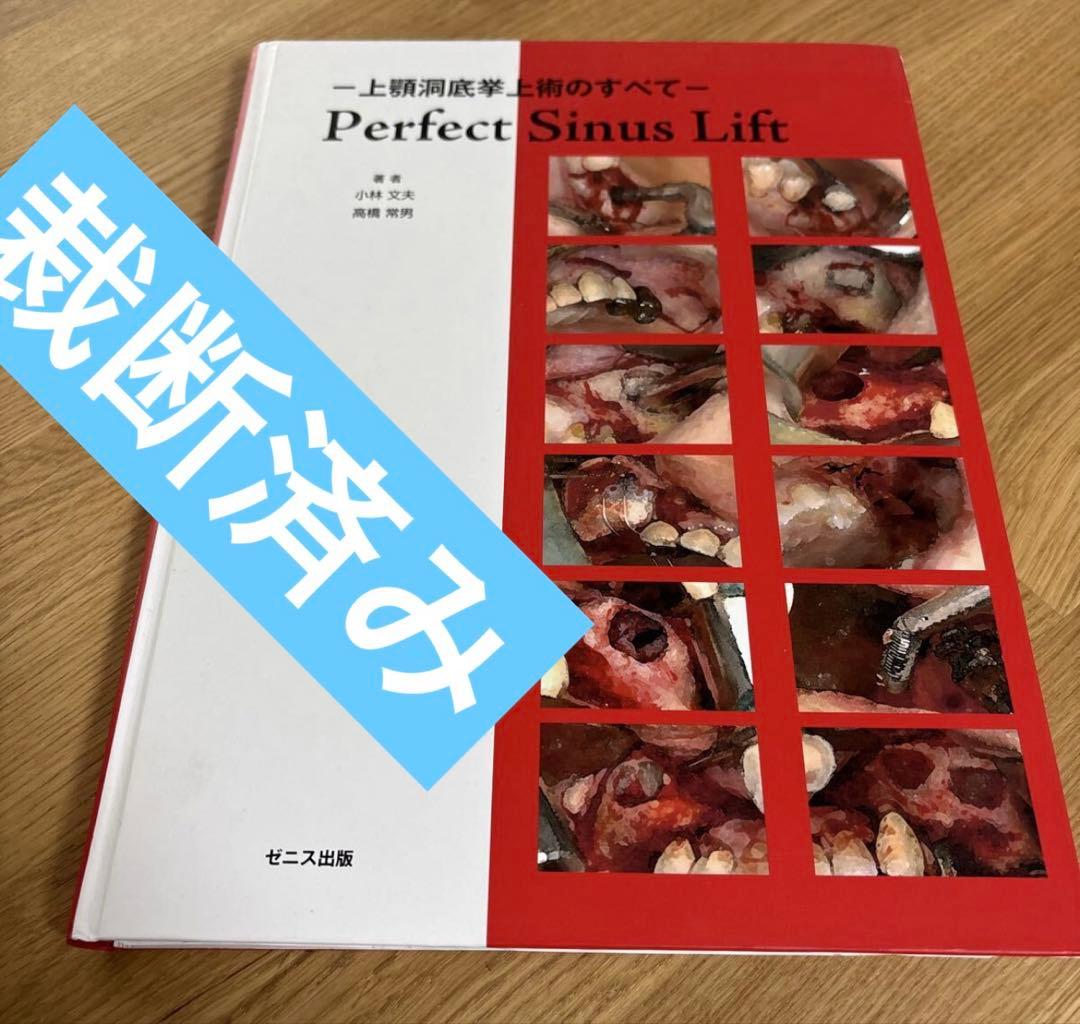 Perfect Sinus Lift - 上顎洞底挙上のすべて